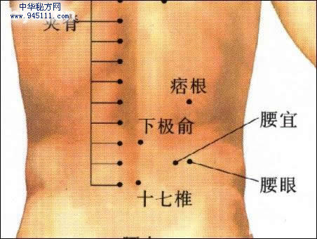 腰痛奇穴--痞根穴 腰痛奇穴--痞根穴
