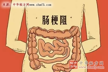 肠梗阻