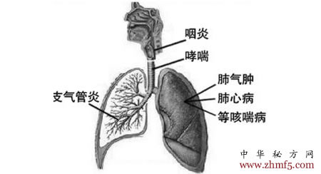 支气管炎